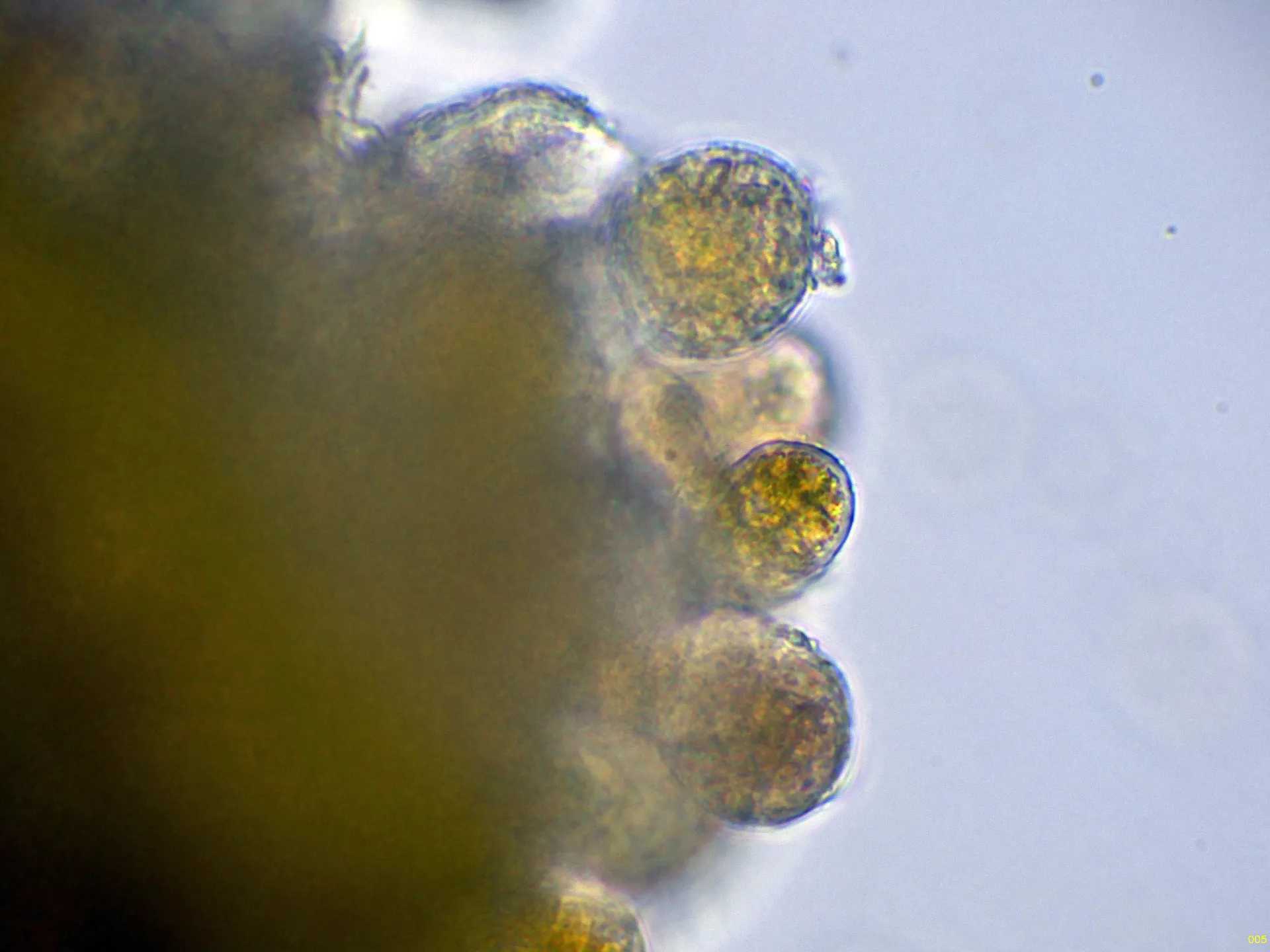 Microscopía de Phragmidium rubi-idaei - 10 - Pared 2